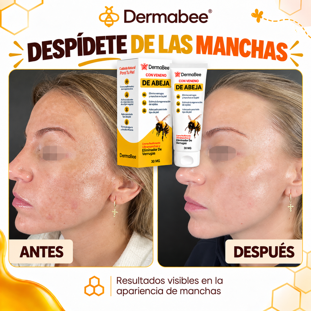 DERMABEE® - Crema tópica con Veneno de abejas para las Verrugas