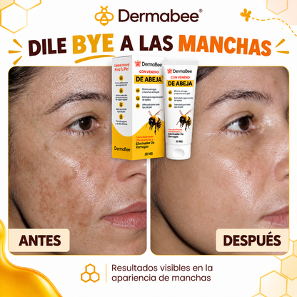 DERMABEE® - Crema tópica con Veneno de abejas para las Verrugas