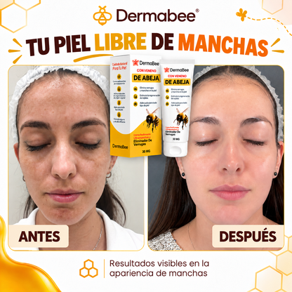 DERMABEE® - Crema tópica con Veneno de abejas para las Verrugas