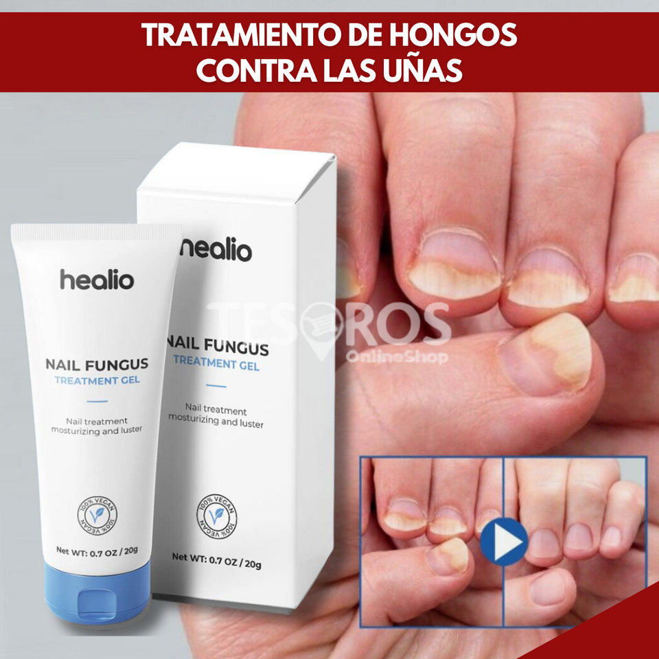 REGENERADOR PRO® - TRATAMIENTO DE HONGOS En GEL 100%EFECTIVO