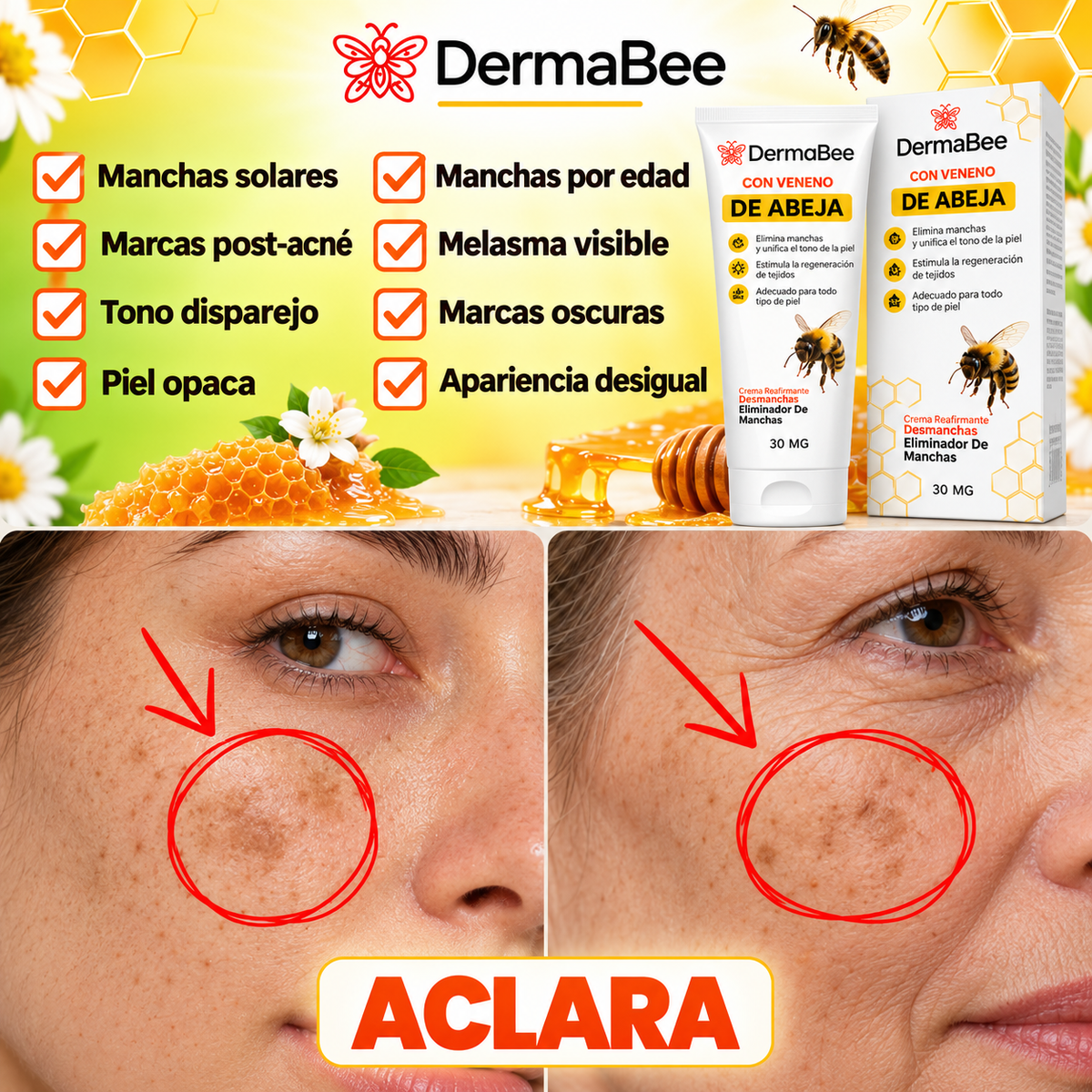 DERMABEE® - Crema tópica con Veneno de abejas para las Manchas