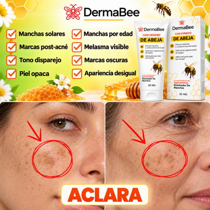 DERMABEE® - Crema tópica con Veneno de abejas para las Manchas