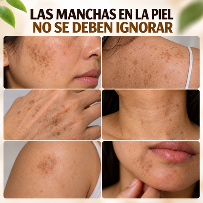 DERMABEE® - Crema tópica con Veneno de abejas para las Manchas